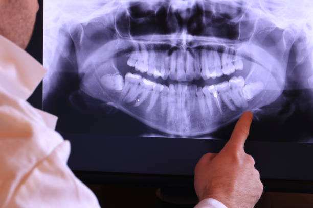 Best Urgent Dental Care for Toothaches in Luling, TX
