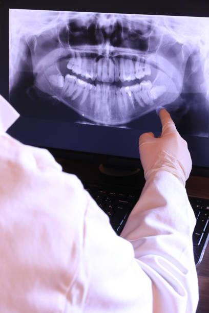 Best Emergency Wisdom Tooth Extraction in Luling, TX