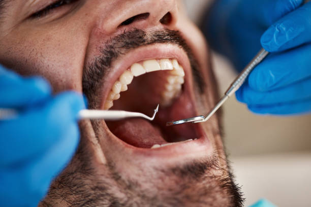 Best Emergency Care for Gum Disease in Luling, TX
