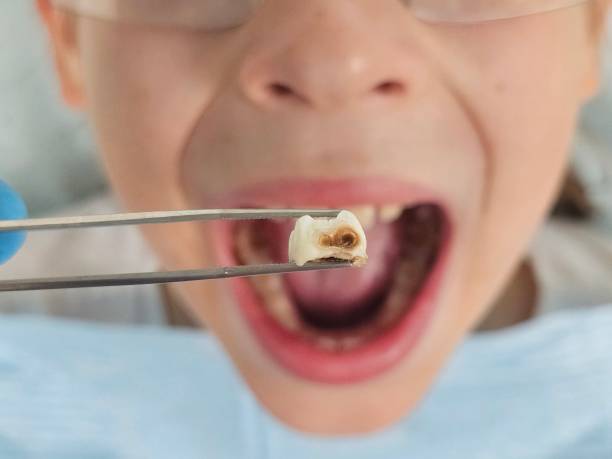 Best 24-Hour Emergency Dental Care in Luling, TX